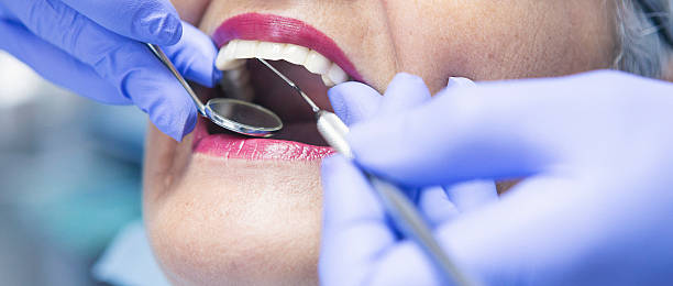 Best Emergency Broken Tooth Repair in Siler City, NC